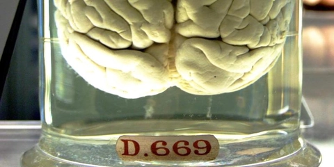 Anatomia Funcional Básica do Cérebro